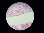 MISSING THUMBNAIL